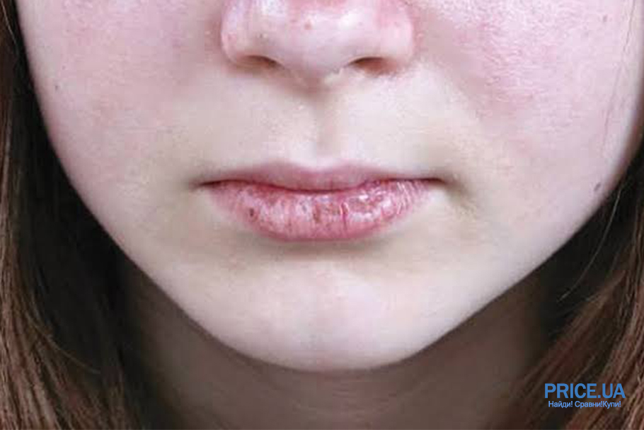 Как выбрать идеальный бальзам для губ: почему трескаются губы
